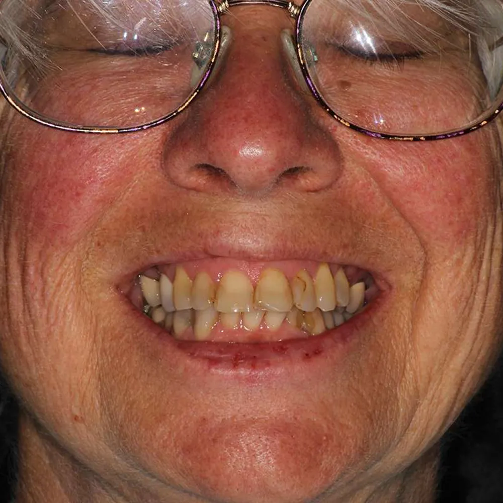 Photo of a patient before and after