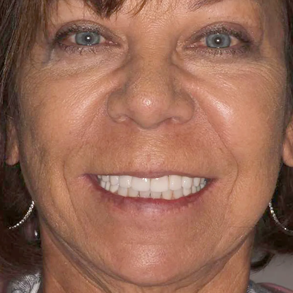 Photo of a patient before and after