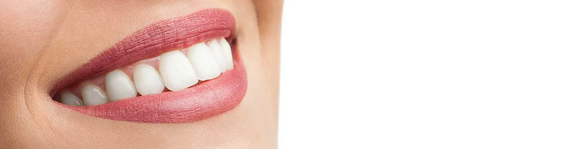 A close-up of a woman smile.