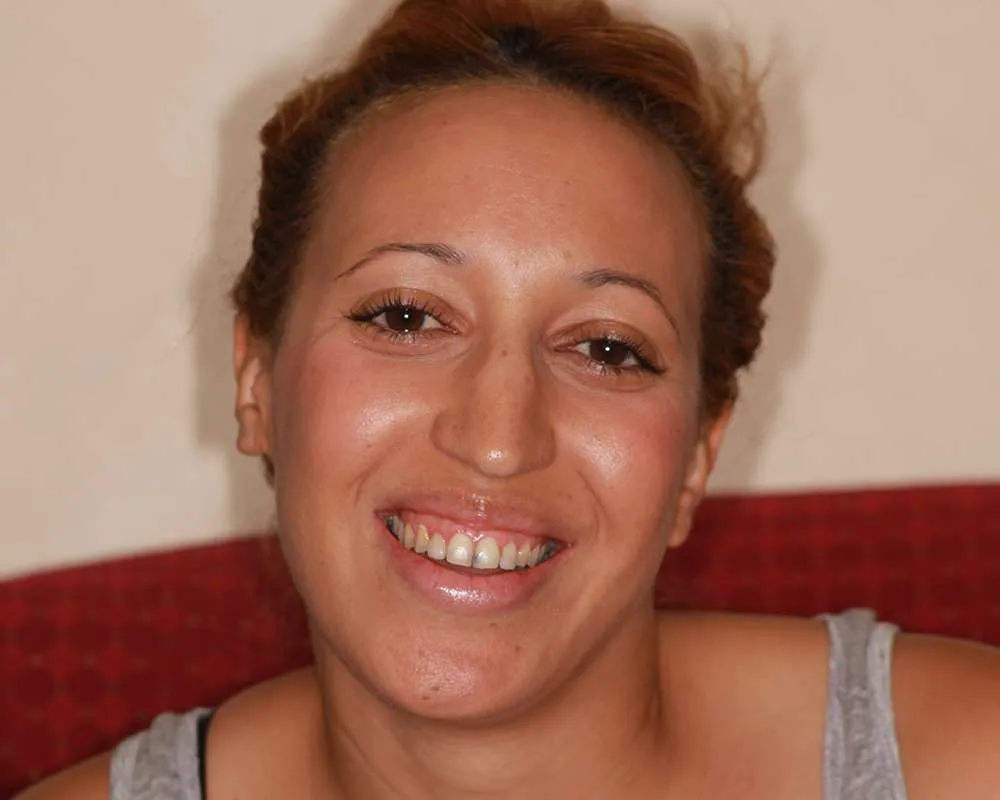 Photo of a patient before