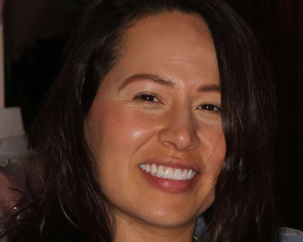 Photo of a patient after