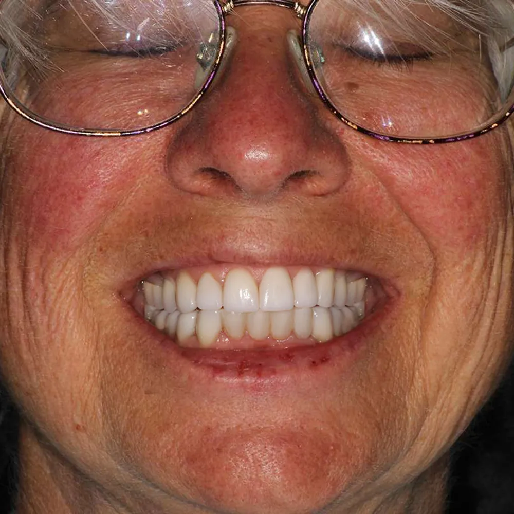 Photo of a patient before and after