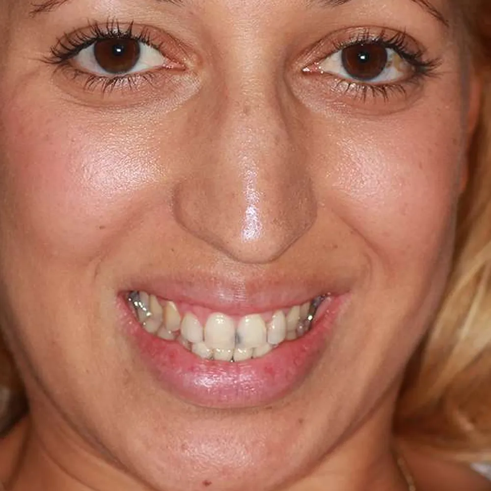 Photo of a patient before and after