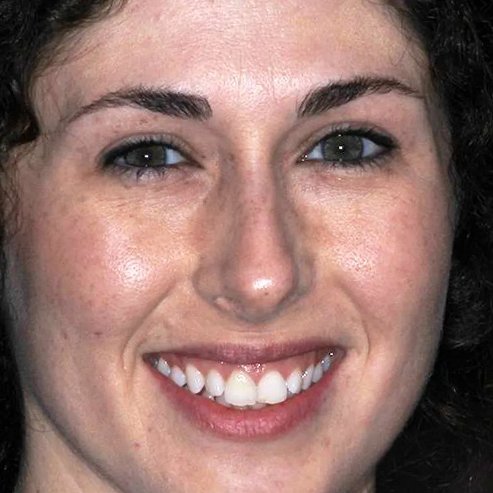 Photo of a patient before and after