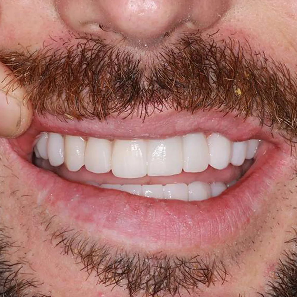 Photo of a patient before and after