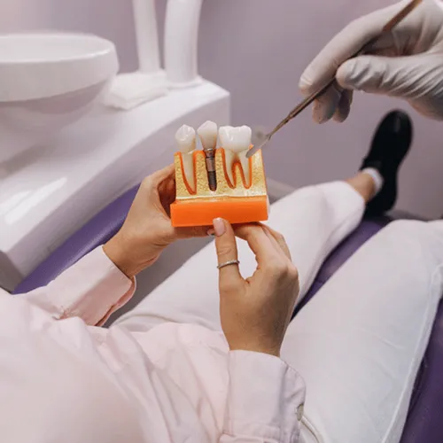 A dentist with a teeth model showing an implant.