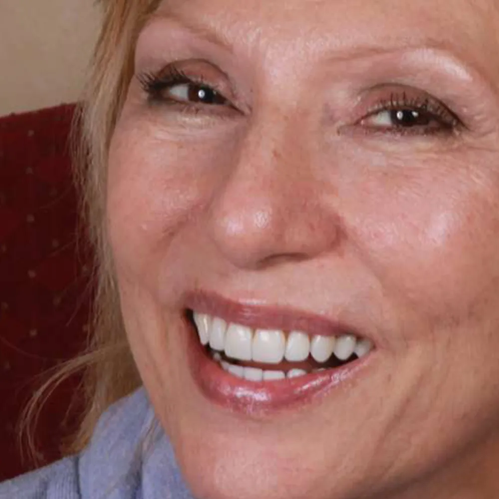 Photo of a patient before and after