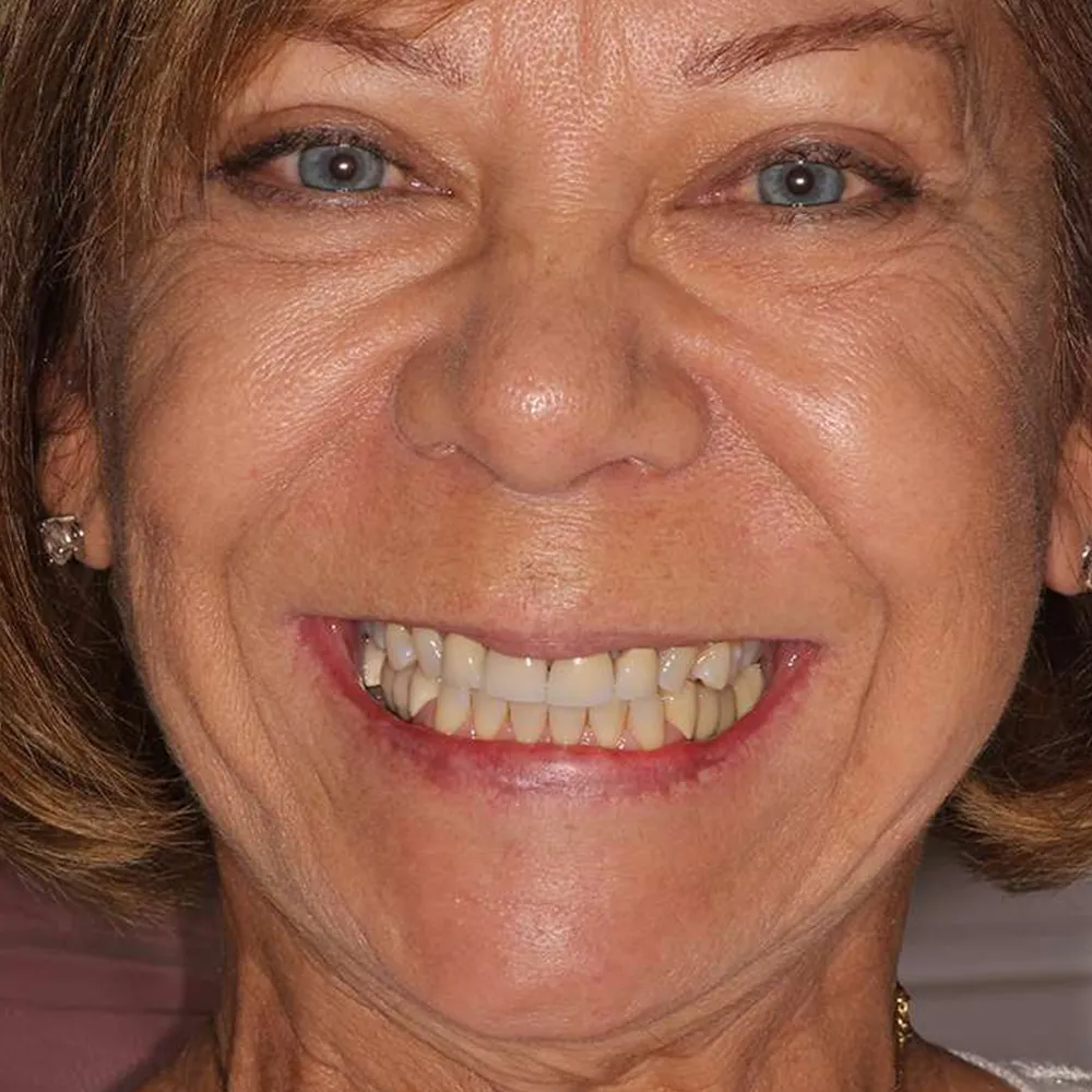 Photo of a patient before and after