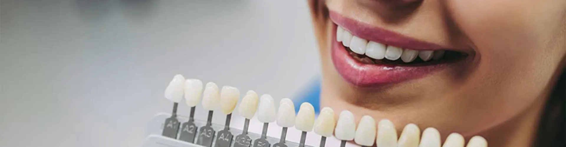 Close-up of smiling woman with veneer samples held in front of teeth.