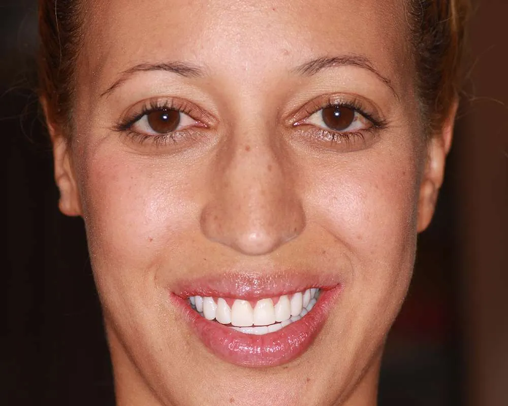 Photo of a patient temps