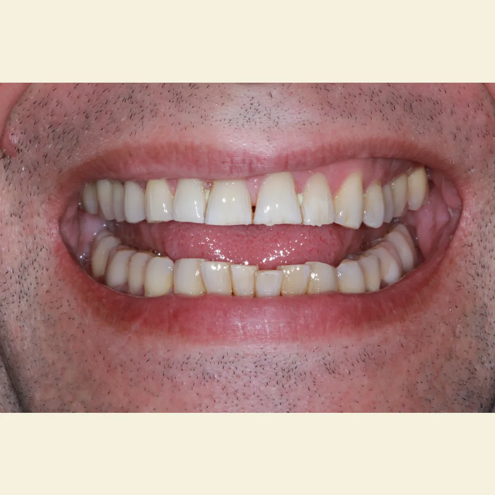 Photo of a patient before and after