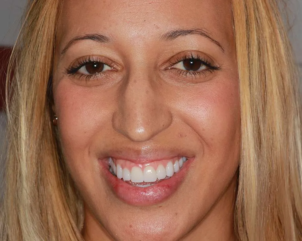 Photo of a patient after