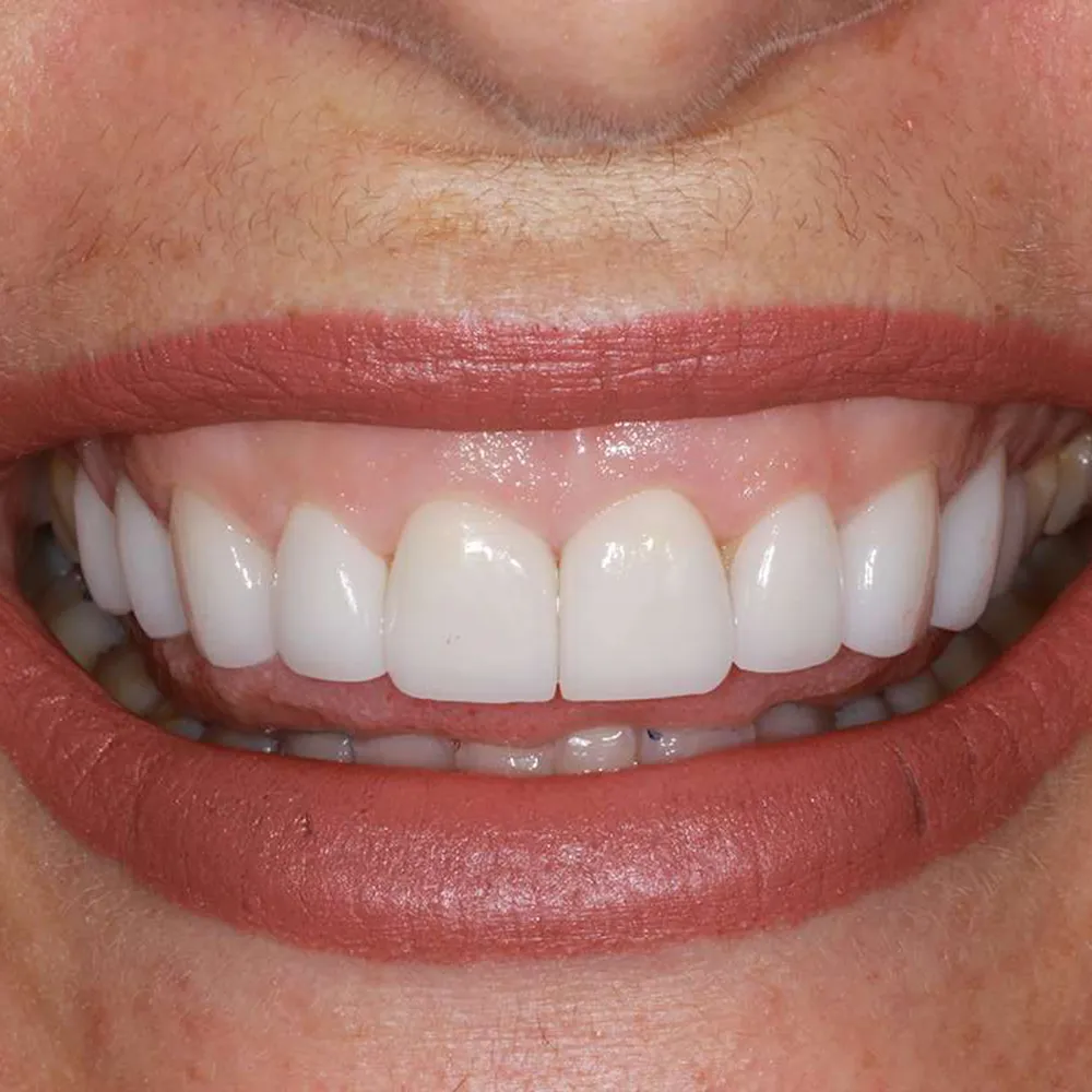 Photo of a patient before and after