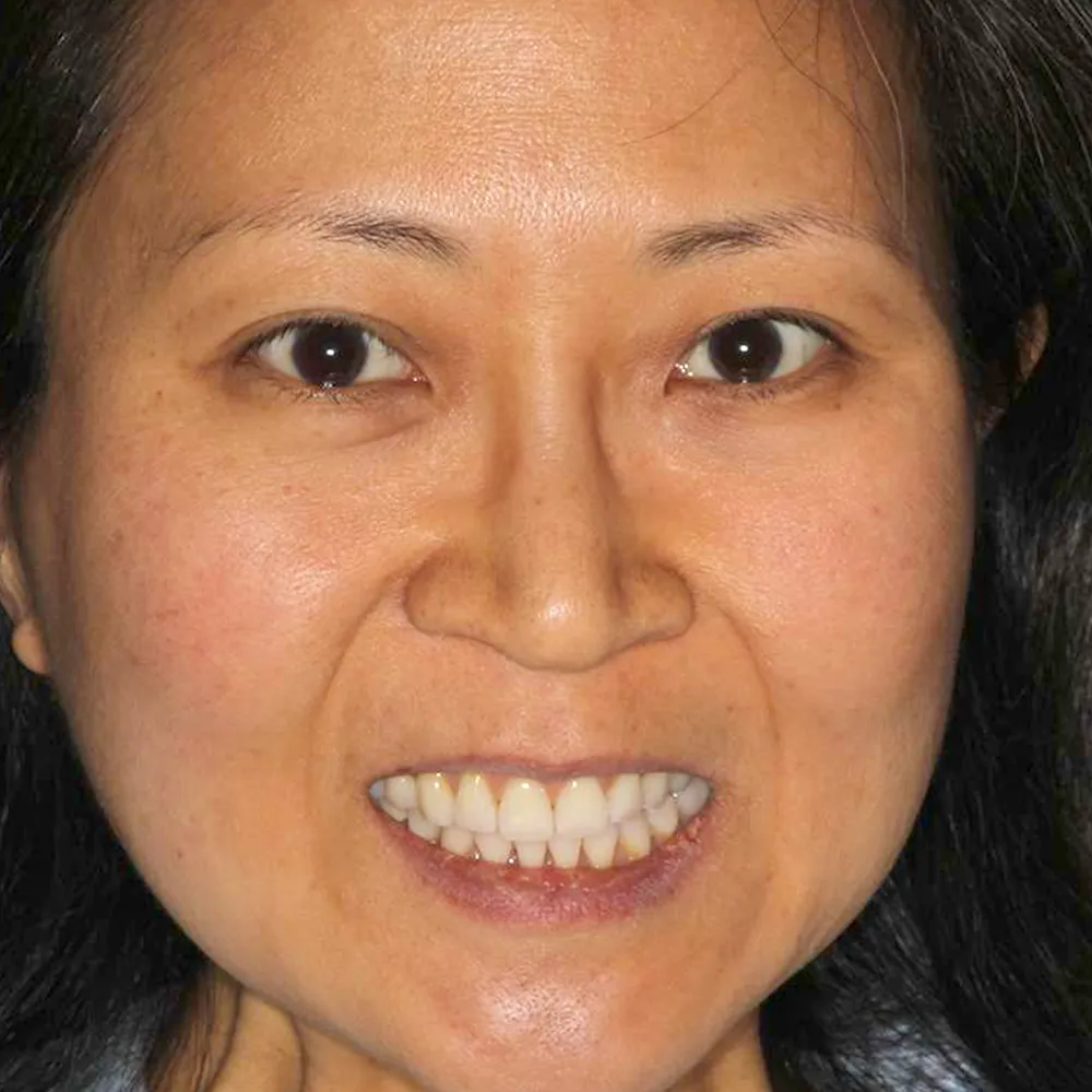 Photo of a patient before and after