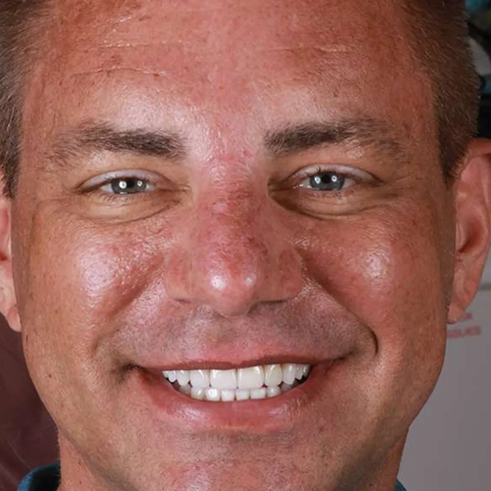 Photo of a patient before and after