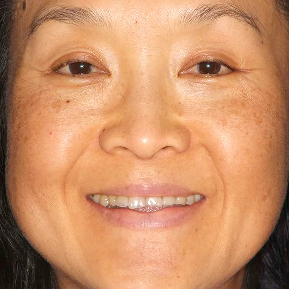 Photo of a patient before and after