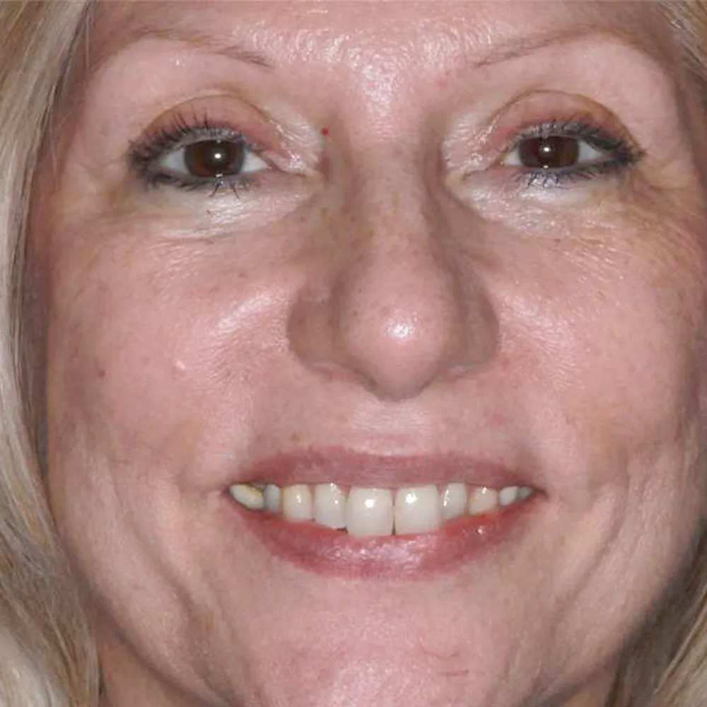 Photo of a patient before and after