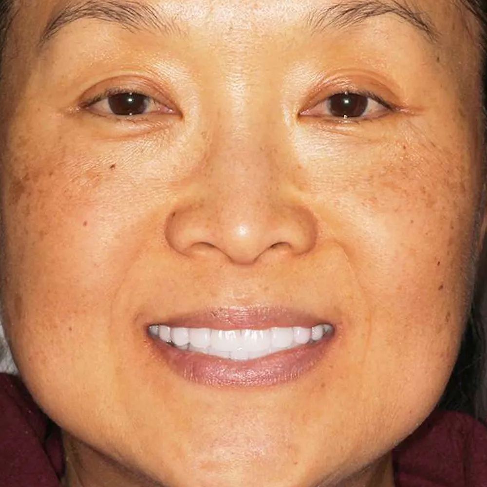 Photo of a patient before and after