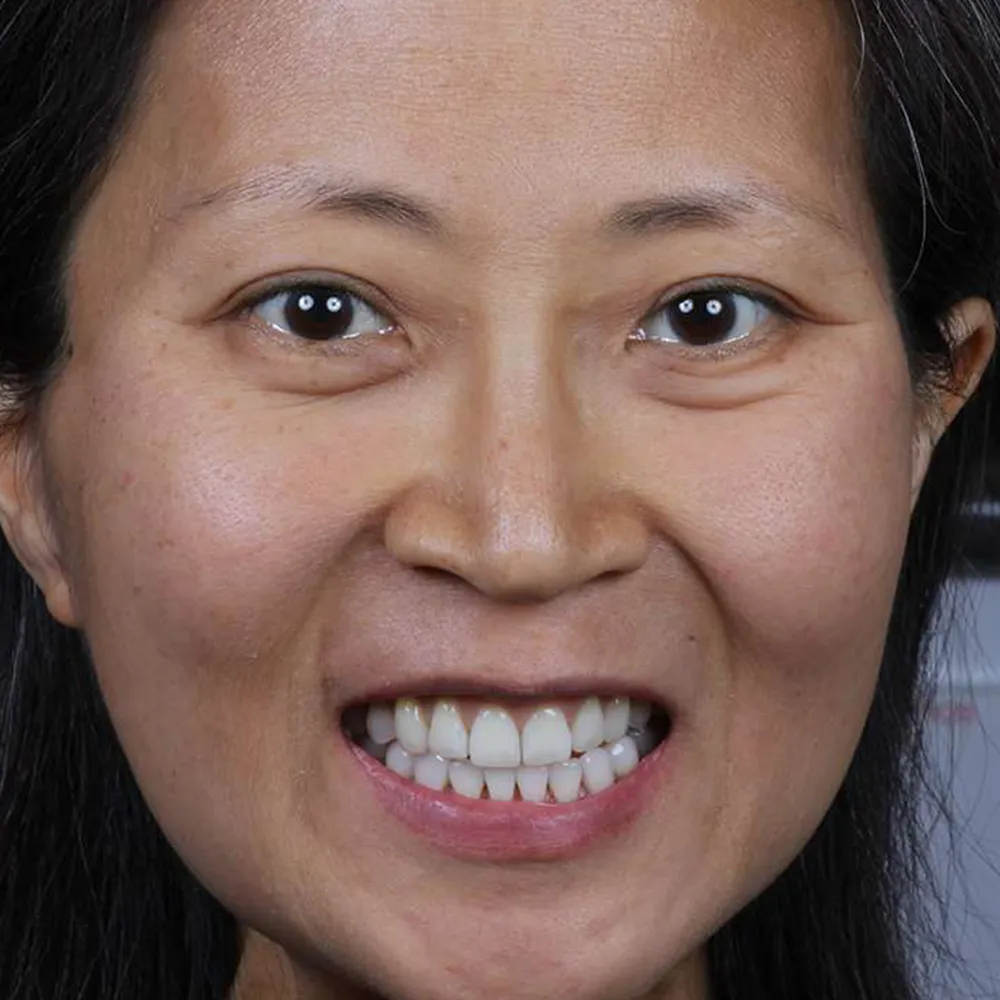 Photo of a patient before and after