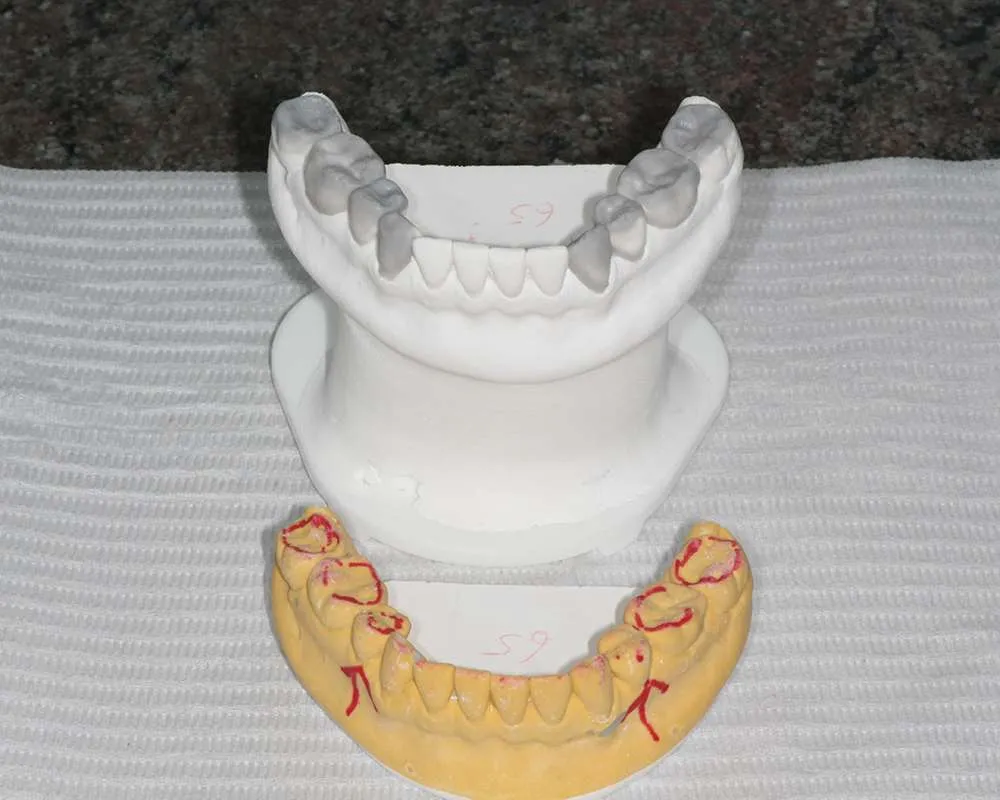 Photo of preplanning case