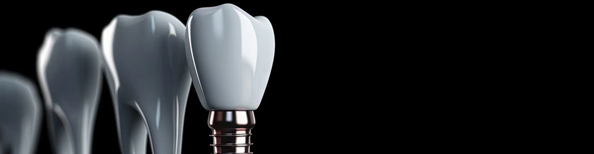 3D render of dental implant beside natural teeth on black background.