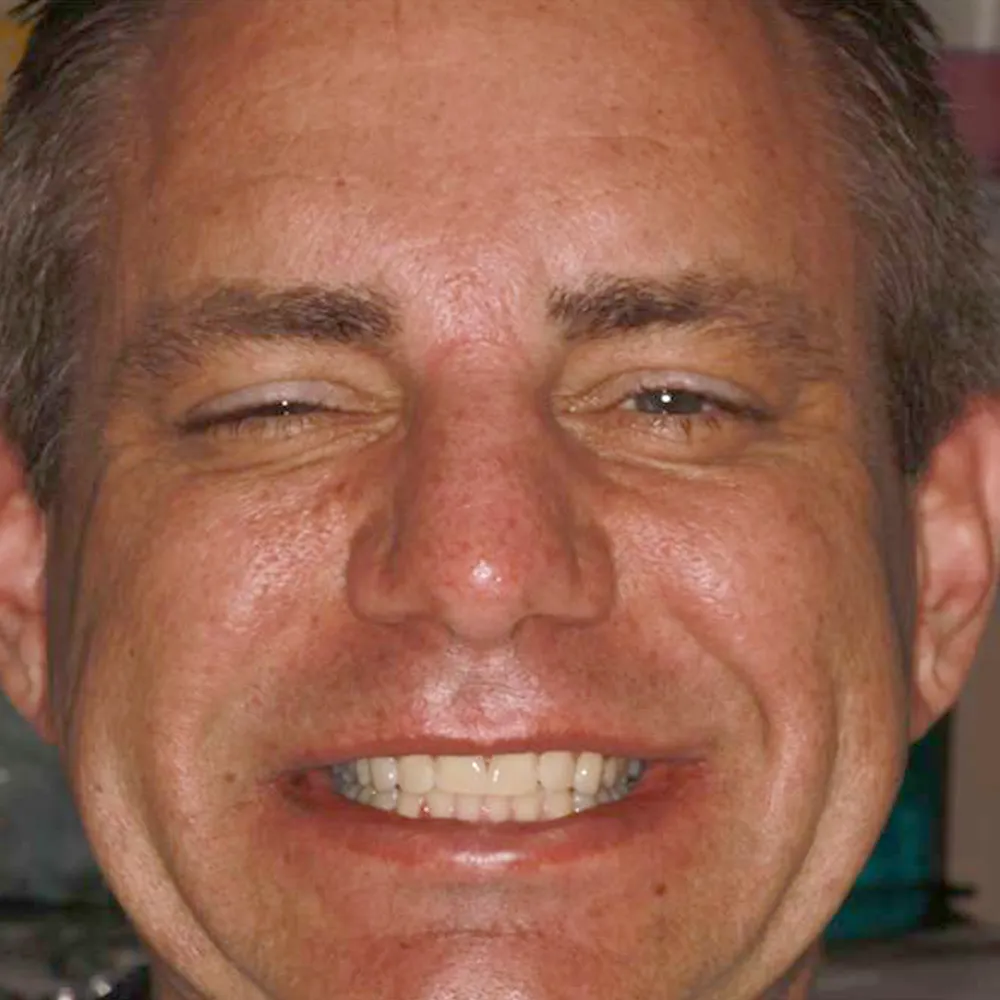 Photo of a patient before and after