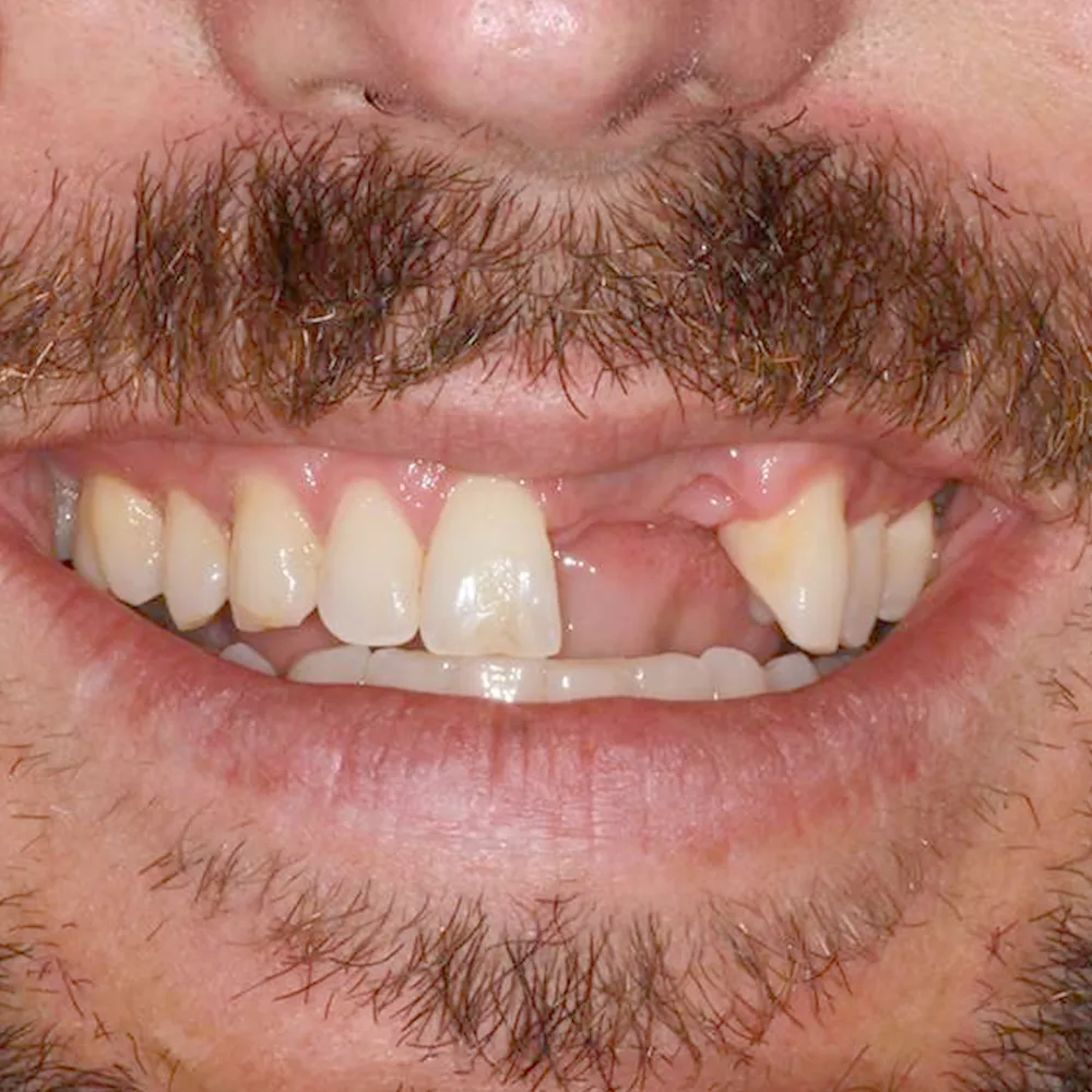 Photo of a patient before and after