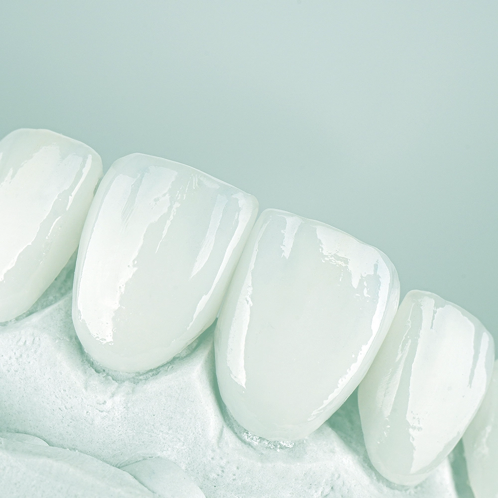 Image of a set of ultra-thin veneers arranged neatly, demonstrating their thin profile and pristine white appearance on a light blue background.
