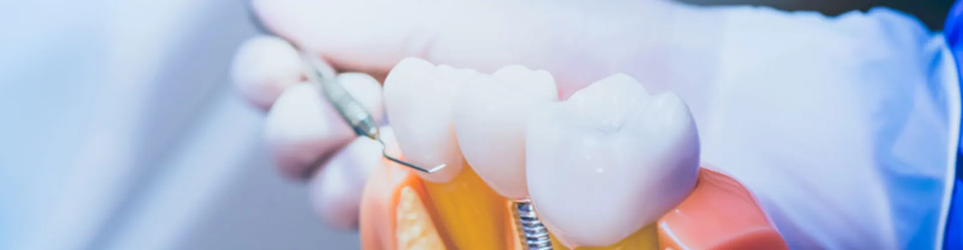 A dentist with a teeth model showing an implant.