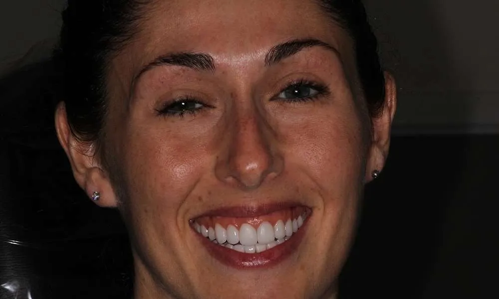 Photo of a patient after