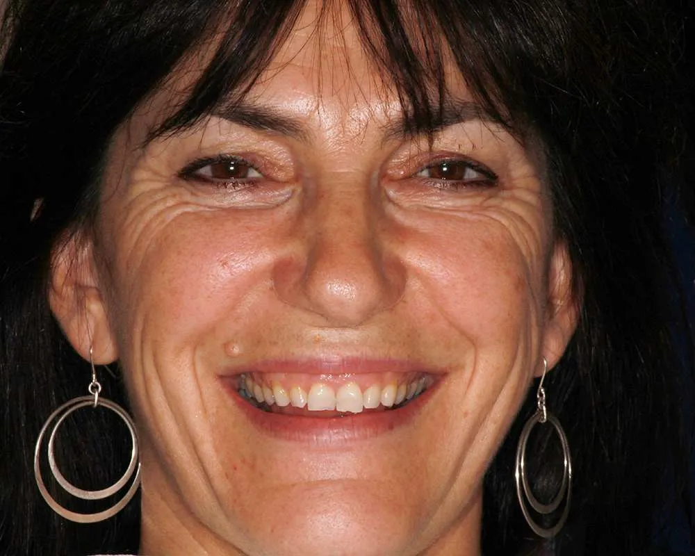 Photo of a patient before