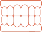 Graphic representation of Full Mouth Reconstruction