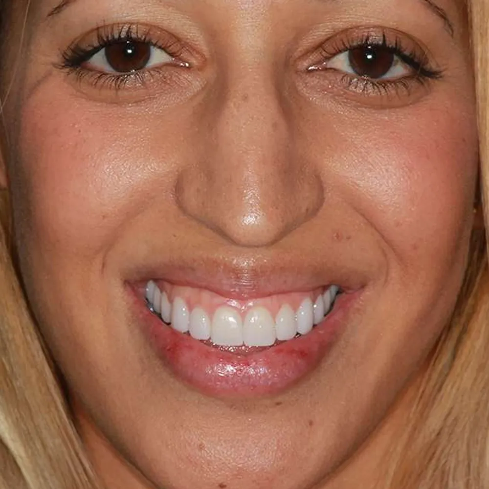 Photo of a patient before and after
