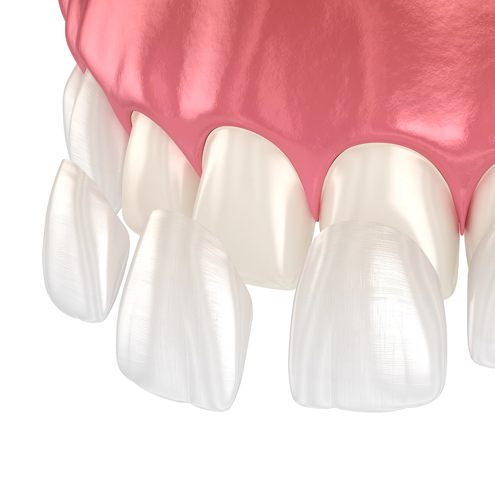 healthy pink gums Tarzana CA