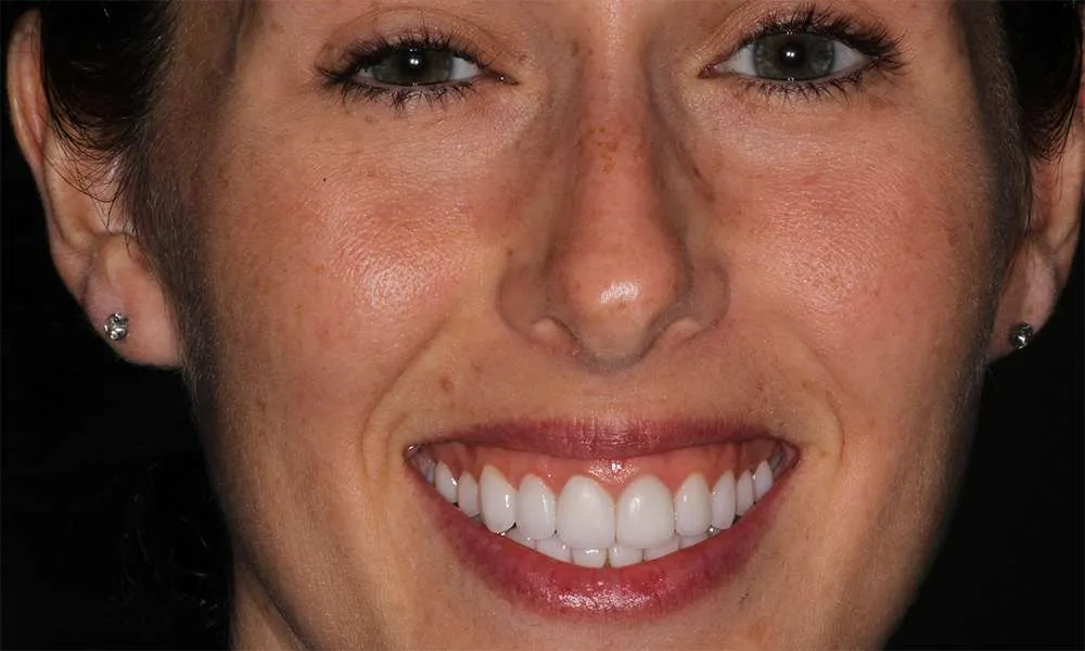 Photo of a patient after