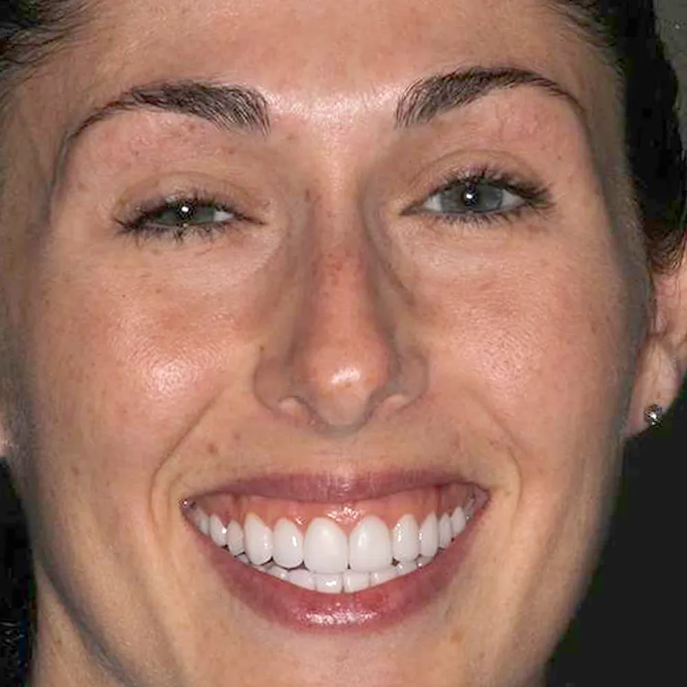 Photo of a patient before and after