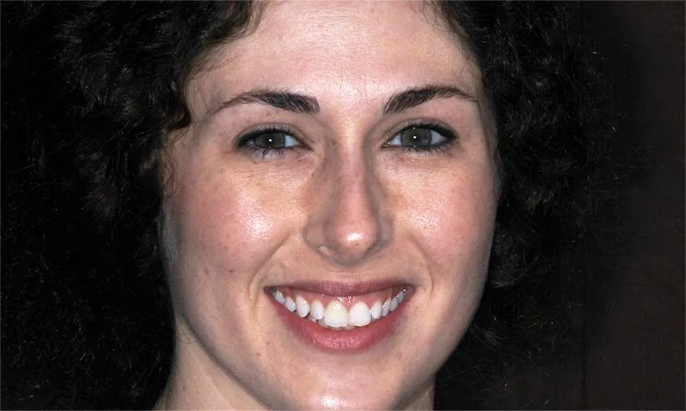 Photo of a patient before 