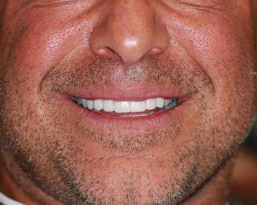 Photo of Temps – Checking Color