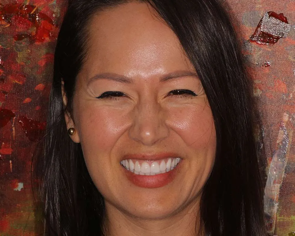 Photo of a patient after