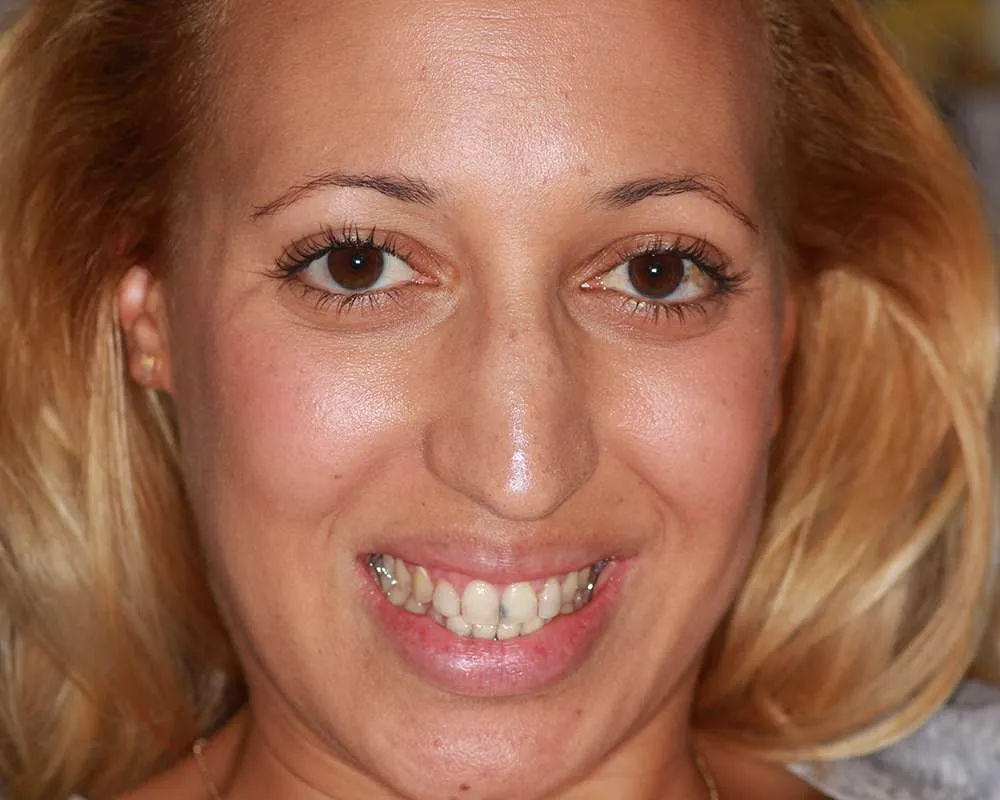 Photo of a patient before