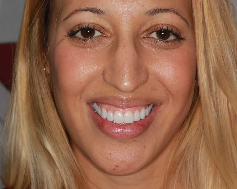 Photo of a patient after