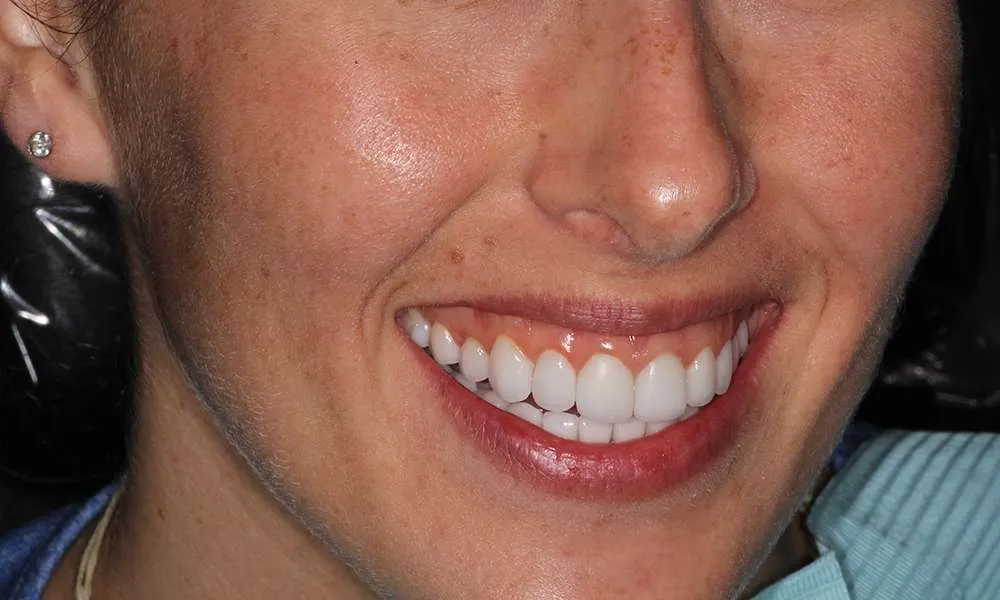 Photo of a patient after