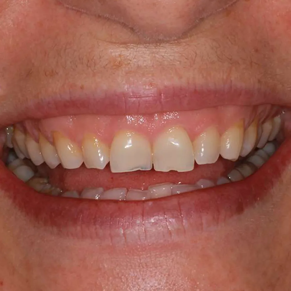 Photo of a patient before and after